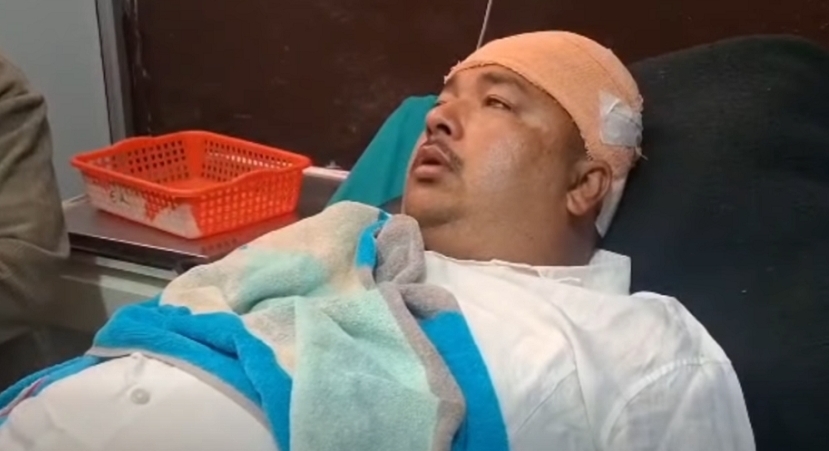 कैलालीका एक वडाध्यक्षमाथि एमाले कार्यकर्ताबाट कुटपिट