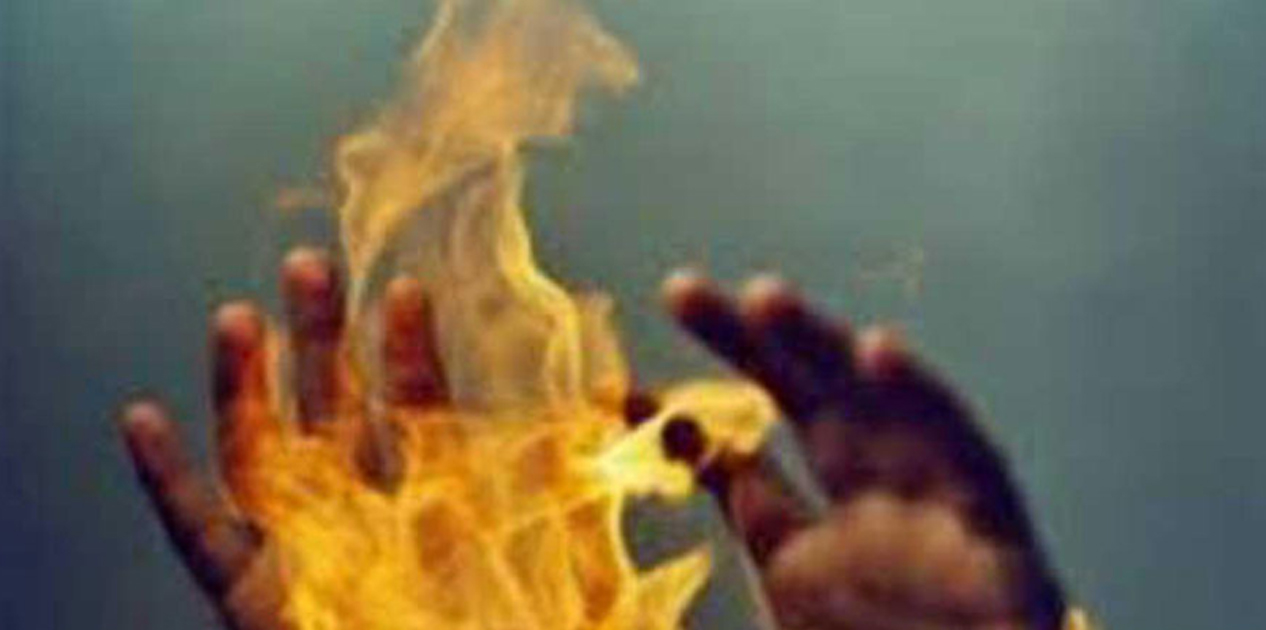 सर्लाहीका आत्मदाह प्रयास युवकको कीर्तिपुरको बर्न अस्पतालमा उपचार हुँदै