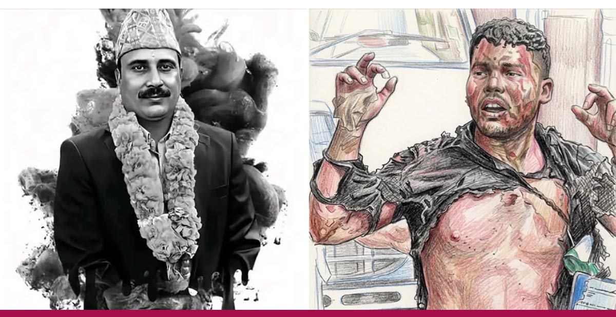 सत्तारुढ सांसद बास्कोटाले भनिन्- प्रेम आचार्यदेखि गणेश नेपालीसम्म उही प्रश्न दोहोरियो